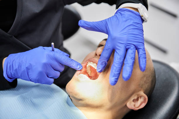 Best Chipped Tooth Repair Near Me  in Dundee, OR